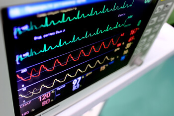 ERP for medical device industry upgrades tracking